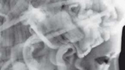 La_tecnica_radiogrfica_en_los_metales_histricos