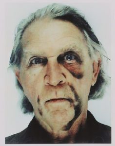 Jimmie Durham. Self-portrait with black eye and bruises [Autorretrato con el ojo morado y contusiones], 2006. Fotografía 144,5 x 104,5 cm. Cortesía de |a Colección Fundación ARCO.